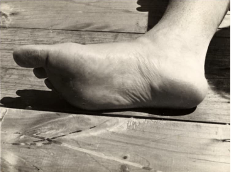 Anton in detail. 2 close-up of sole of foot