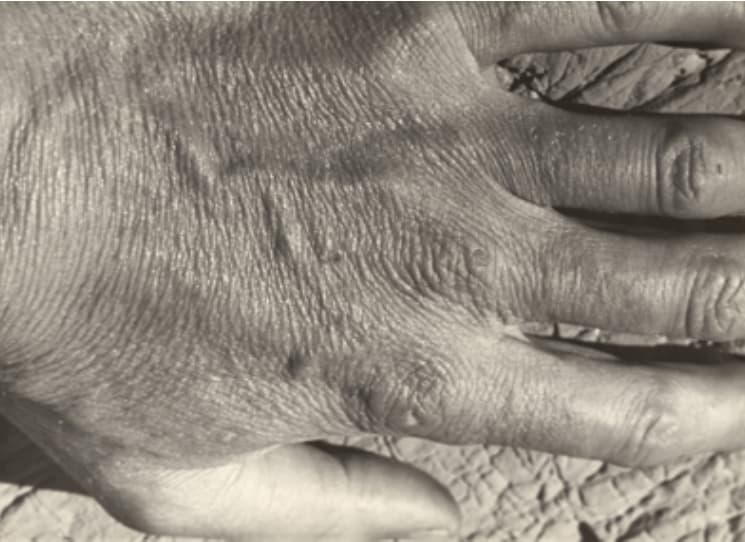 Anton en detail. 5, Nahaufnahme einer faltigen Hand