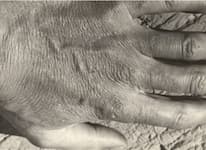 Anton en detail. 5